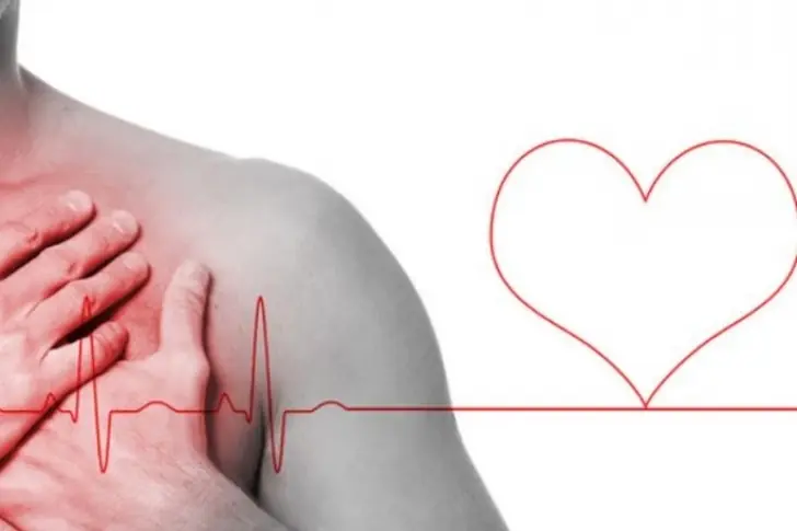 Enfermedades cardiovasculares son la primera causa de muerte
