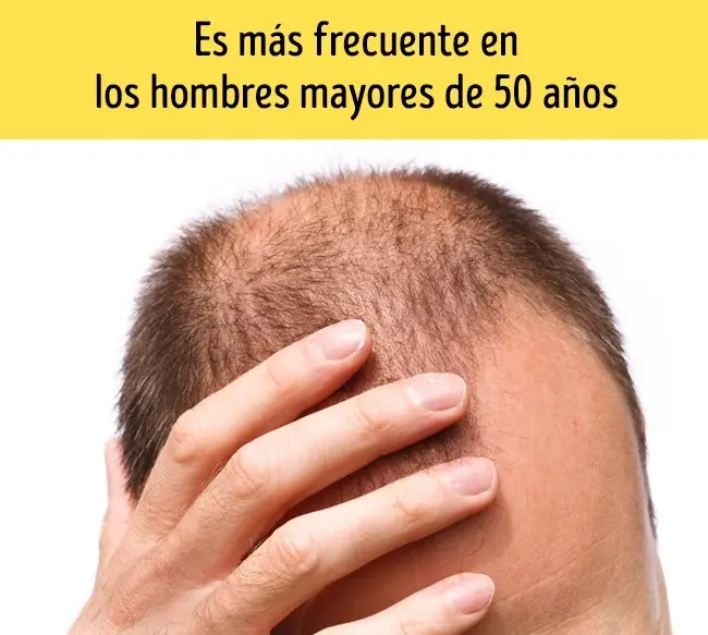 8Sintomas que advierten un mes antes de un ataque al corazon