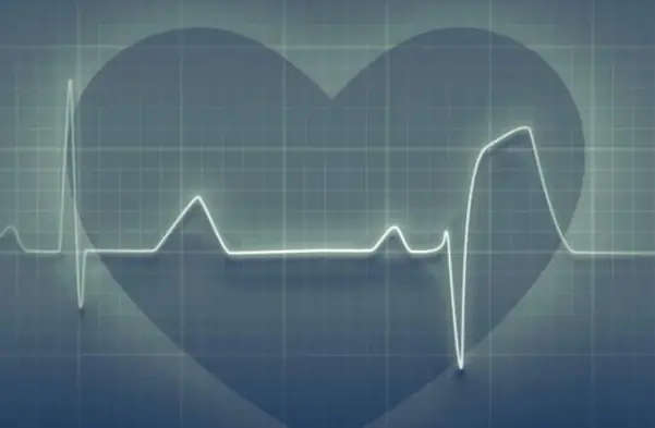Como identificar y prevenir un infarto al corazón