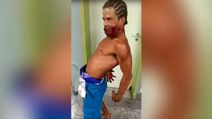 Posesion demoniaca en hospital de brasil