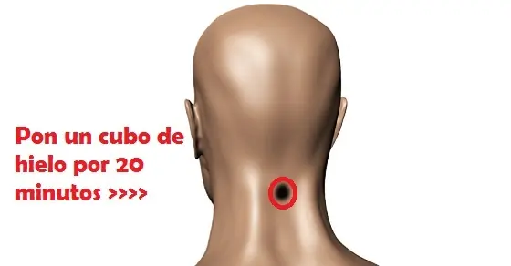 Increibles beneficios de aplicar hielo en la nuca