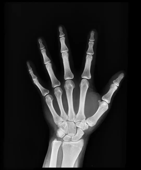 El magnesio es más importante para tu salud d lo que piensas El magnesio es más importante para tu salud d lo que piensas
