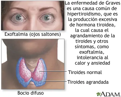 raro