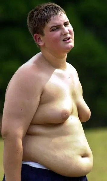 aunataque aunataque