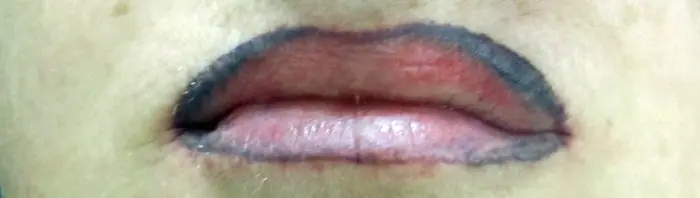 Personas que tatuaron sus labios y fallaron en el intento