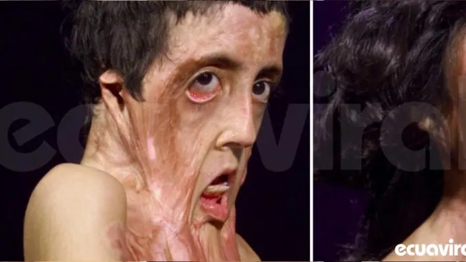 Hombre se llevó a la niña para operarla, así luce despues