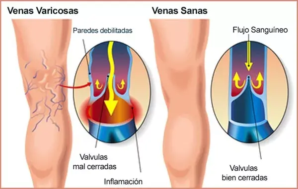 sangre