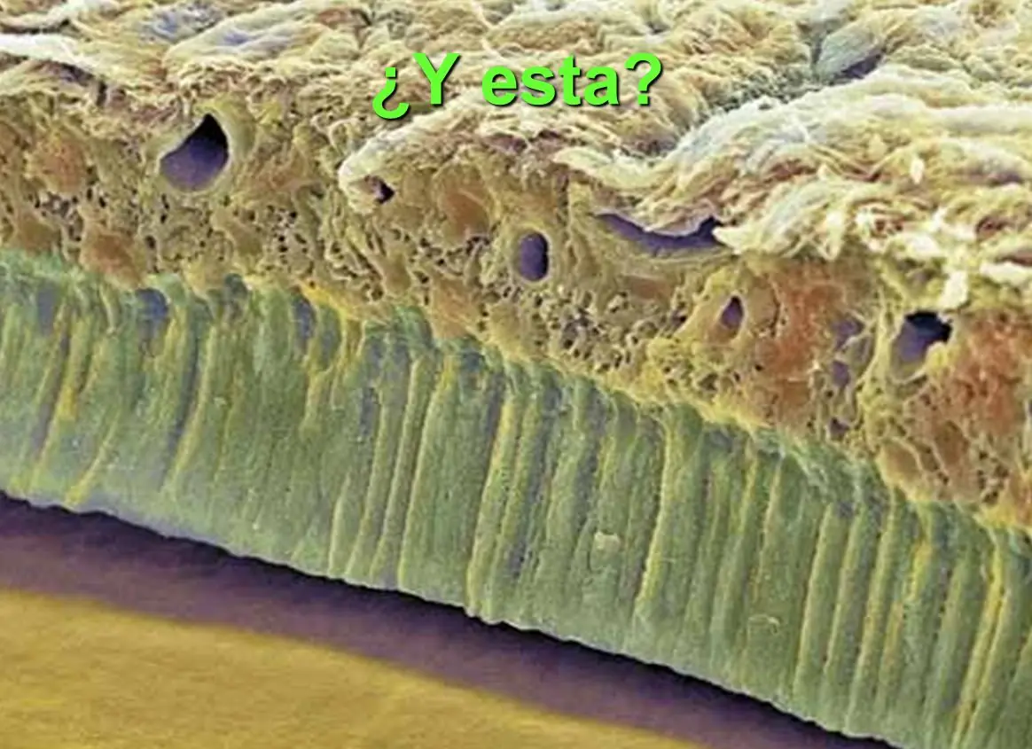 esperma