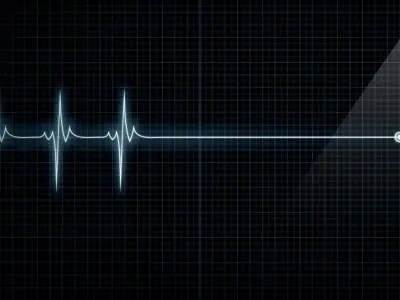 El cerebro se mantiene consciente después de la muerte