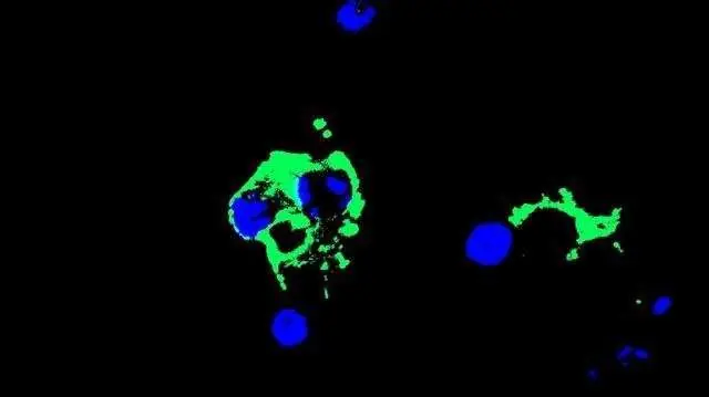 El virus del Zika infecta el cerebro en desarrollo
