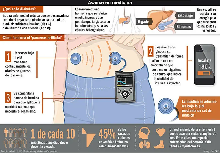 Prueban un páncreas artificial desarrollado en Argentina