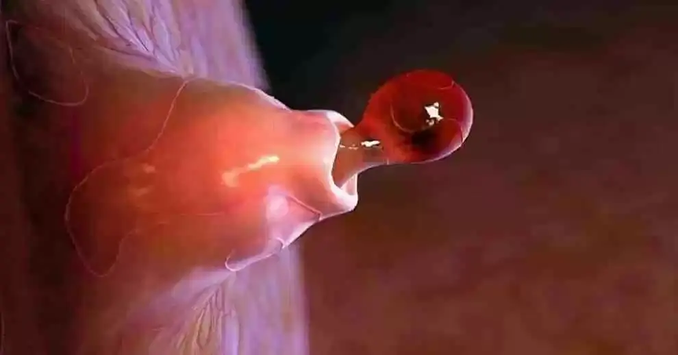 microscopicas