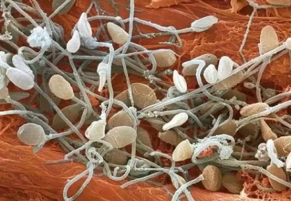 Cuerpo humano: 18 fotos microscópicas