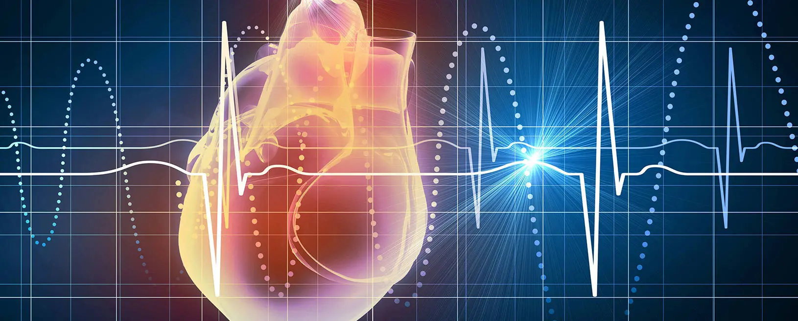 El electrocardiograma