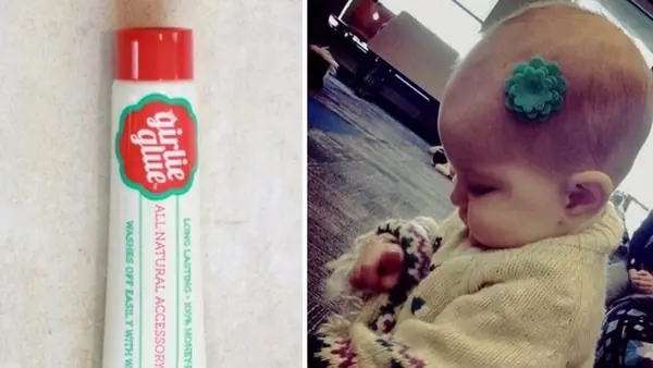 Madre indignada por la calvicie de su bebé, inventó este