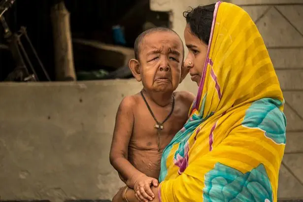 El verdadero Benjamin Button: tiene 4 años pero parece de 8