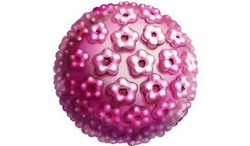 papiloma