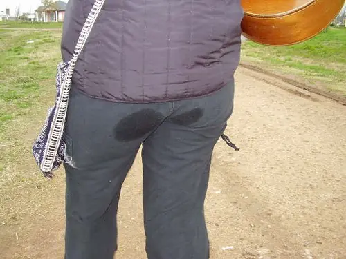 calor