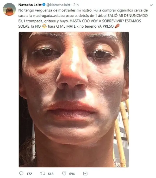 Fuerte imagen de Natacha Jaitt golpeada por su ex pareja
