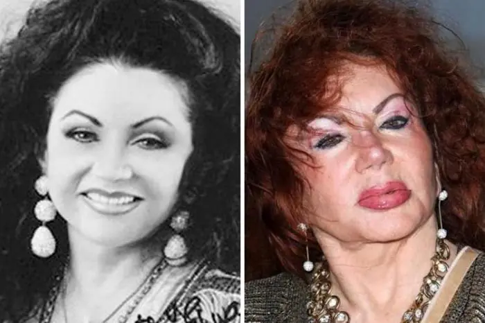 Mujeres que estaban mucho mejor antes de la ciguría plástica