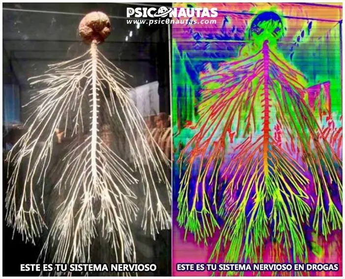 imagenes