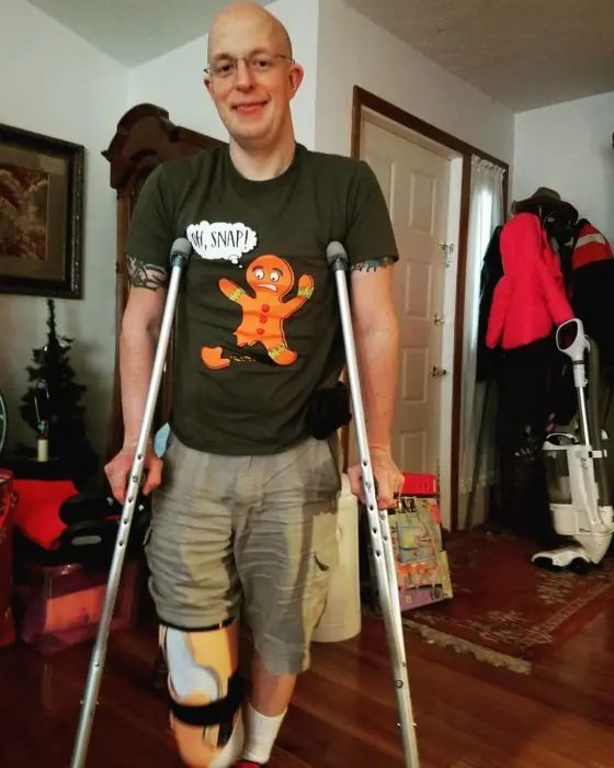 Personas Amputadas q tienen un sentido del humor envidiable