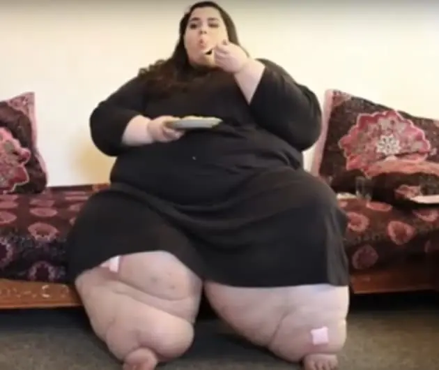 A los 25 años pesaba casi 300 kg y decidió cambiar su vida