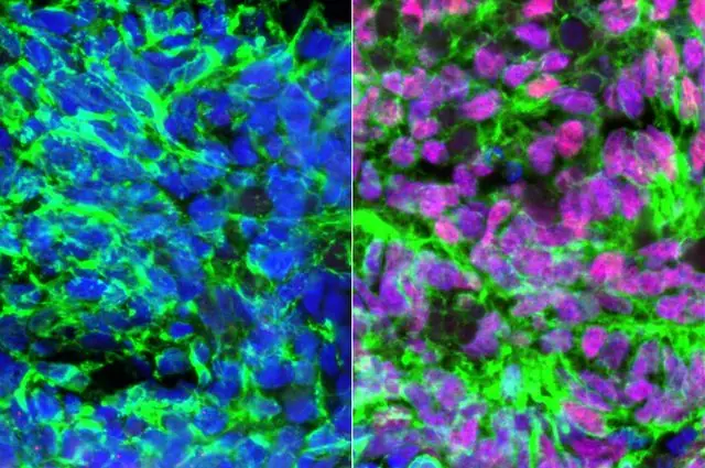 Científicos crean células con sentido del tacto