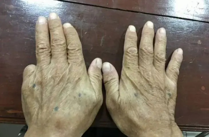 exmiembro