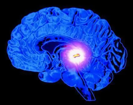 La glándula pineal