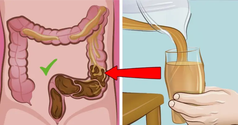 Salva tu colon con estos valiosos tips