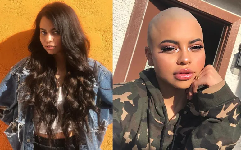 Las extensiones de cabello la llevaron a raparse la cabeza