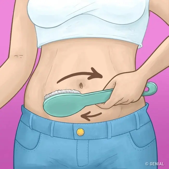 celulitis