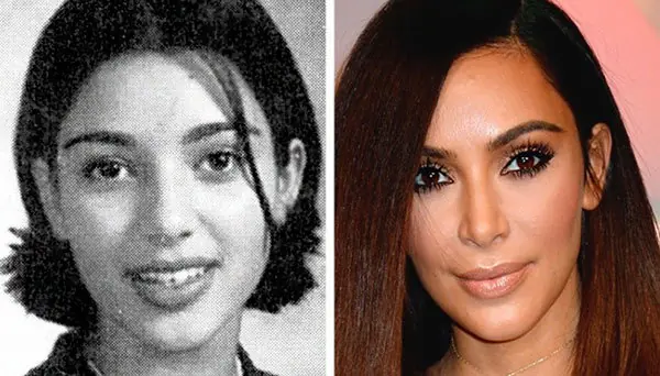 12 famosos que no temieron mostrar sus fotos de adolescentes