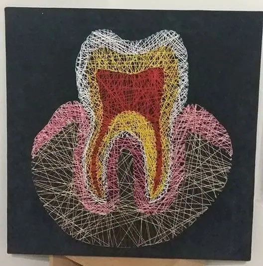 hilos