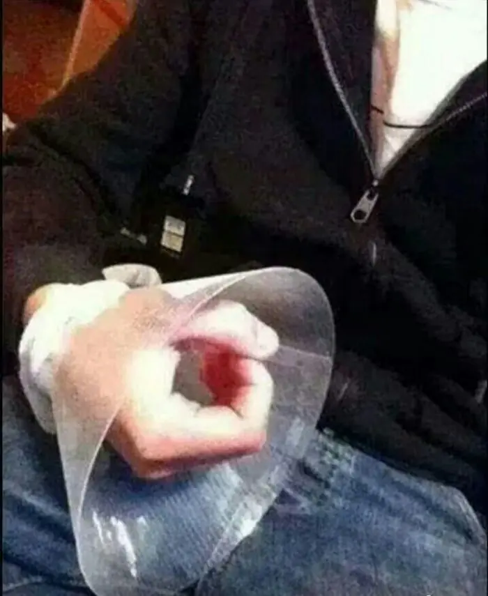 Me rompí la mano y te lo muestro