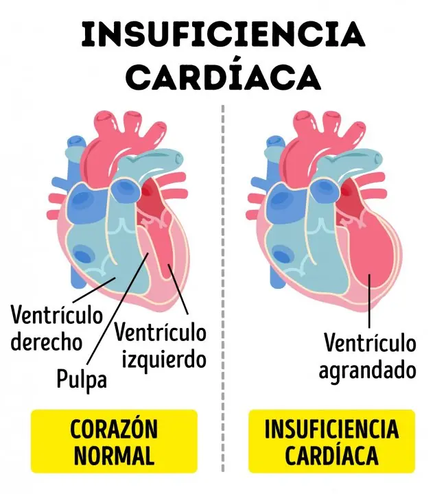 vida