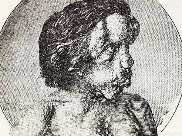 Estas son las 13 anomalías médicas más extrañas del mundo