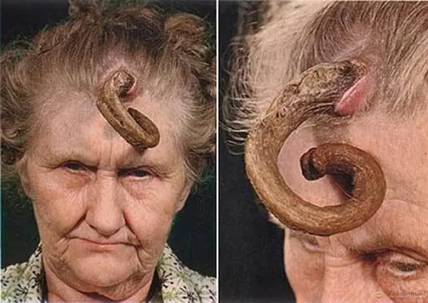 Estas son las 13 anomalías médicas más extrañas del mundo
