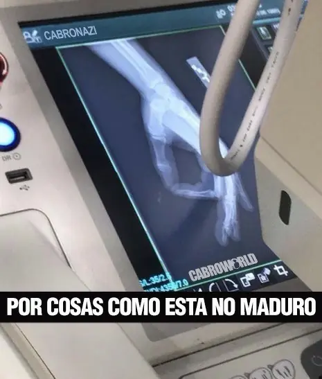imagenes