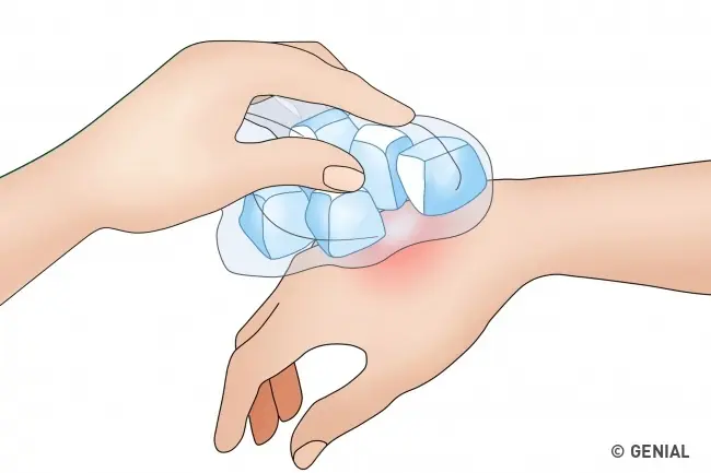 5 Cosas que hacer lo más pronto posible si t picó una avispa