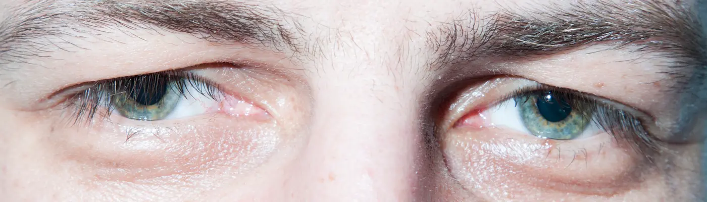 Asi se ven tus ojos cuando estas drogado