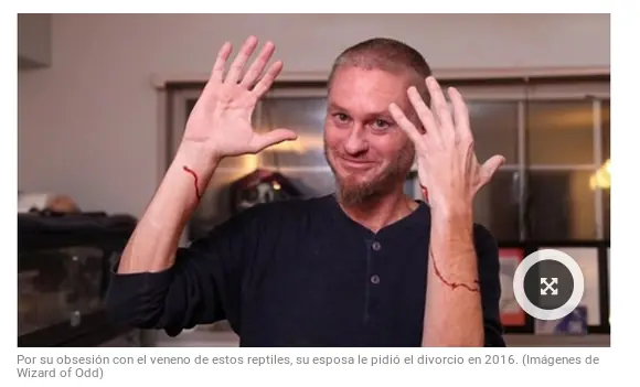 Se deja morder por serpiente para buscar la cura del veneno
