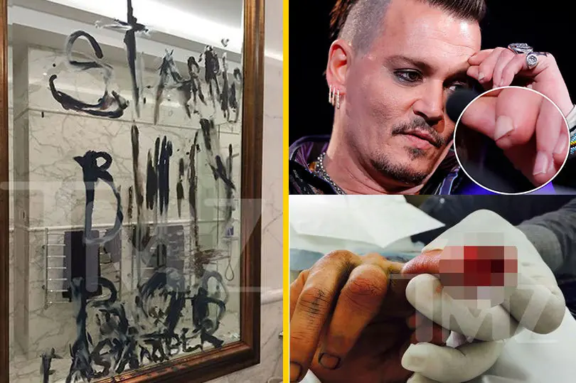 13 Famosos que sufrieron una amputacion y no tenías idea