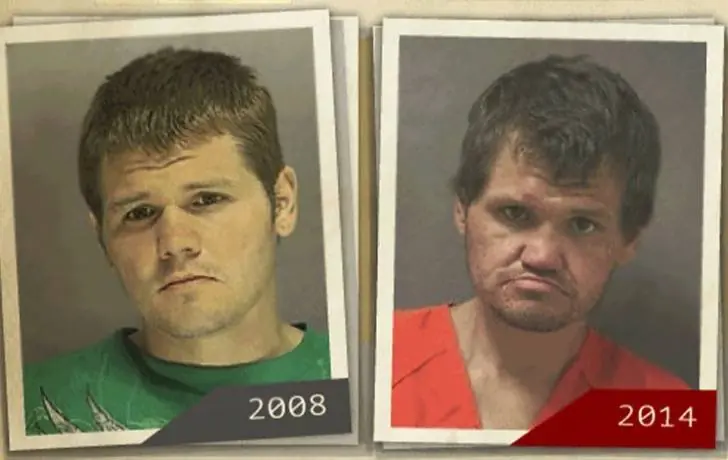 Antes y después de 15 personas adictas a las drogas
