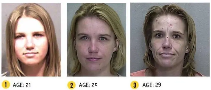 Antes y después de 15 personas adictas a las drogas