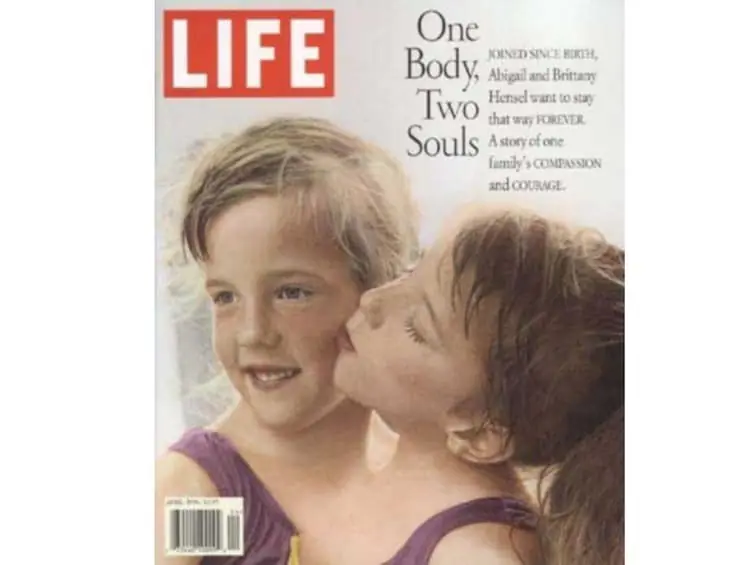 Asi es la vida de Abby y Brittany, las gemelas siamesas