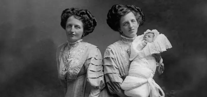 La triste historia de las siamesas de Bohemia