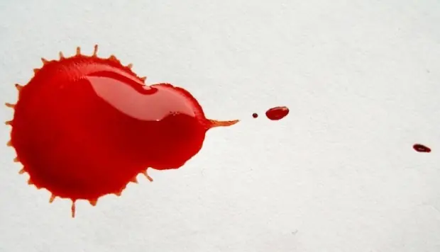 Hemofilia no debe obligar al paciente a vivir en una burbuja