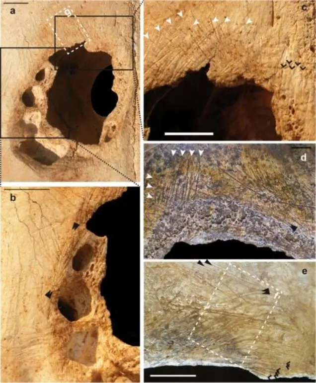 cirugia cirugia